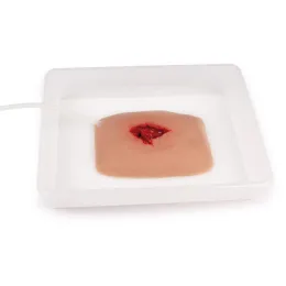 Wundmoulage Wound Packing